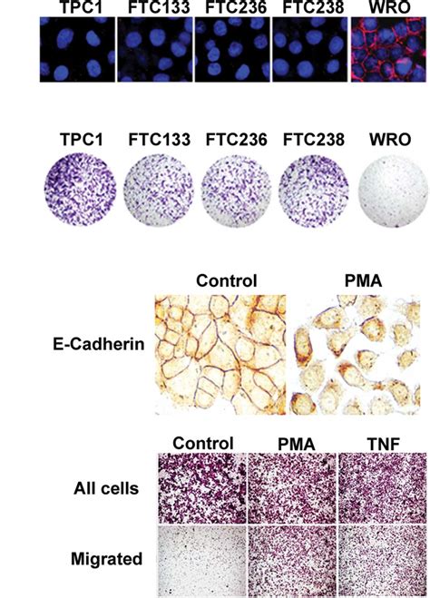 Dynamic Changes In E Cadherin Gene Promoter Methylation During