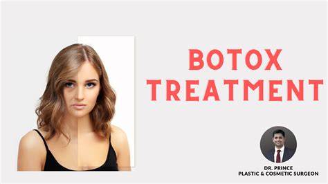 Rejuvenation Redefined Aesthetic Elegance With Botox By Dr Prince Topplasticsurgery