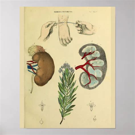 Operation Handgelenk Nacken Anatomie Kunst Drucken Poster Zazzle De