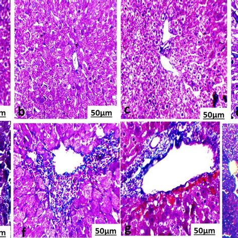 Photomicrograph of spleen section of a normal mouse and b not infected ...