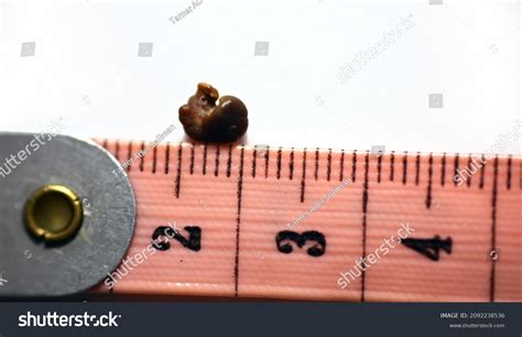 Nephrolithiasis Single Irregular Brown Kidney Stone Stock Photo