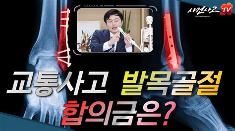 보상정보 교통사고 발목골절 합의금 얼마나 될까요 188화 사건사고tv