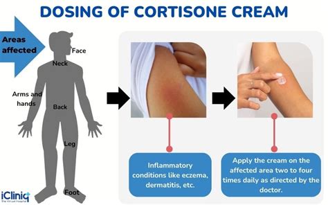 Cortisone For Rashes