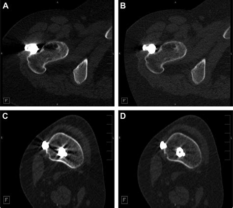 Pediatric Applications Of Dual Energy Computed Tomography Radiologic