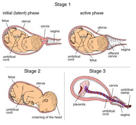 stages  labor  birth explained labor flow chart  phases