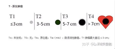 【影像笔记】关于第八版国际肺癌的分期解读 知乎