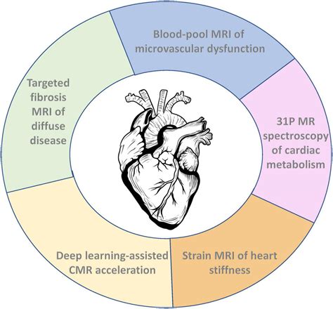 structural heart disease wieji