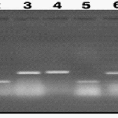 Ethidium Bromide Stained Agarose Gel Electrophoresis Showing The