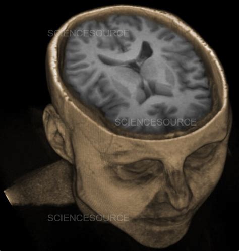 Photograph Normal Brain 3d Mri Science Source Images