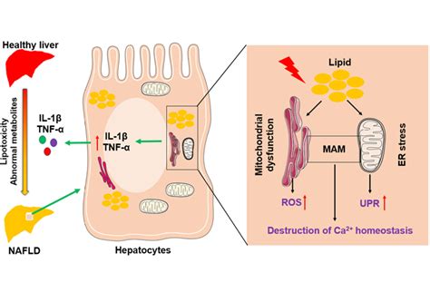 Molecular Targets Regulating Endoplasmic Reticulum Mitochondria