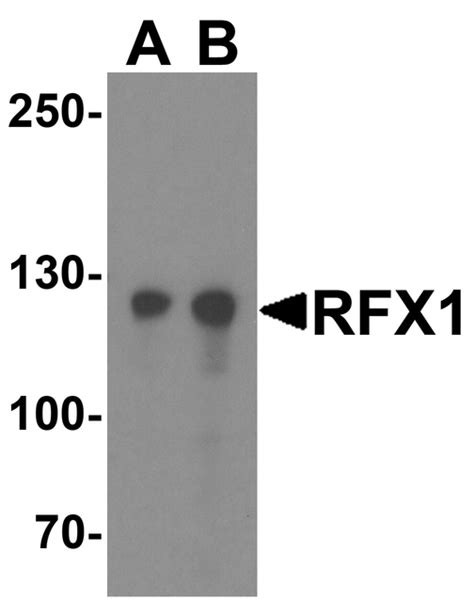 Ihc Plus Rfx Rfx Polyclonal Antibody Rabbit Anti Human Lsbio