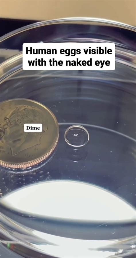 Human Egg Visible With The Naked Eye Ivf Instagram Wonder