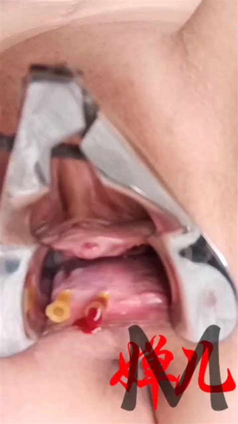 Needles In Asian Slave Pussy ThisVid