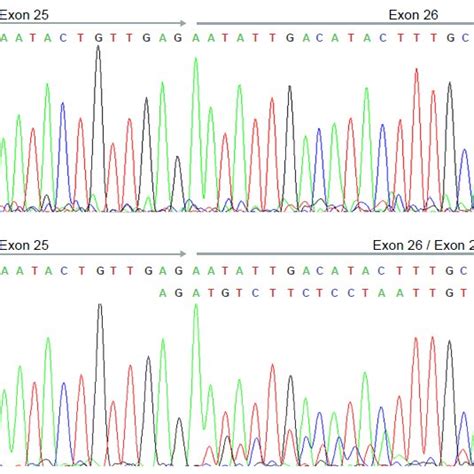 Cdna Sequence Chromatograms Panel A Showing Sanger Sequencing Of A