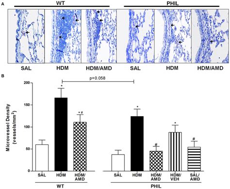 Microvessel Density Mvd Assessed By Immunostaining For Von Willebrand