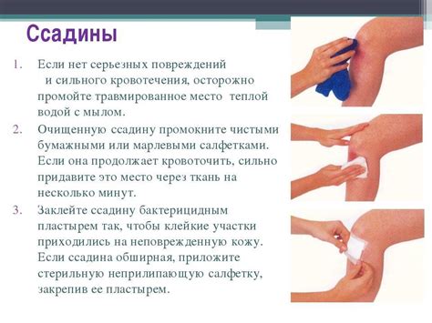 Чем обработать рану у ребенка после падения - как лечить мокнущую ...