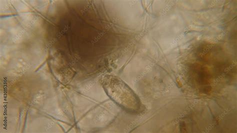 Vidéo Stock Bacteria Parasites And Worms In Drinking Water Under