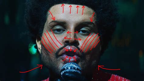 The Weeknd Plastic Surgery 2024 Surgery Journey All Details