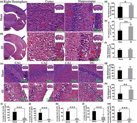 The Changes Of Brain Tissue Morphology In Rats At Hours After Hi