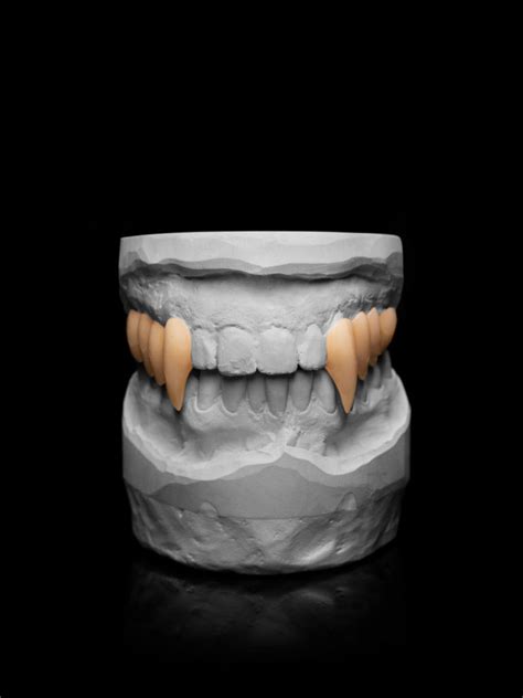 Fx Teeth Systems We Use Alphabite