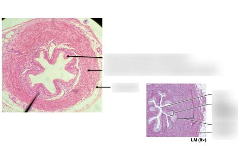 BSC 216 Anatomy Lab Exam 3 Ureter Histology Diagram Quizlet