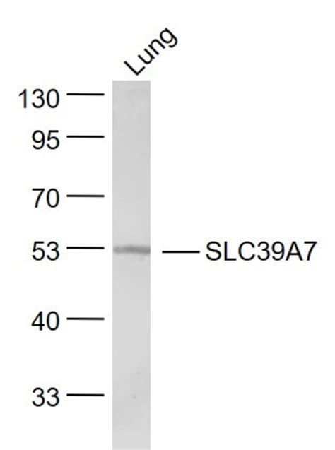 SLC39A7 Rabbit anti Human Polyclonal Bioss 100 μL Unconjugated