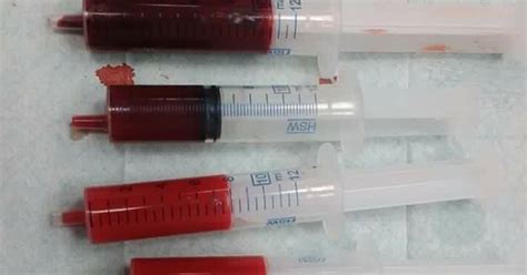Biologia é Vida!: Sangue arterial X sangue venoso