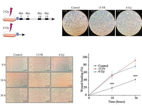 Ionizing Radiation IR Leads To Morphological Changes And Enhanced