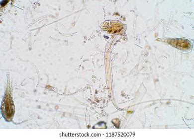 Marine Aquatic Plankton Under Microscope View Stock Photo 1187520079 ...