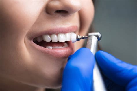 Dental Scaling Vs Dental Cleaning Whats The Difference