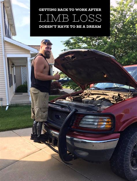 Our patient Hayden Bailey... - Dream Team Prosthetics LLC | Facebook