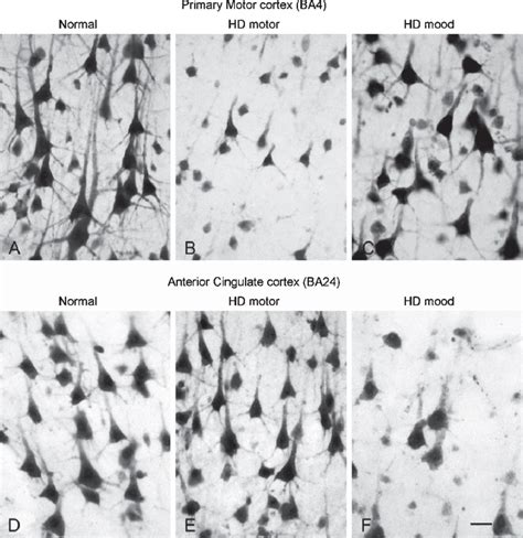 Photomicrographs Illustrating The Pyramidal Neurons In Layer Iii In The