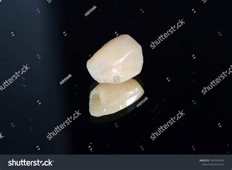 temporary crown royalty  images stock  pictures shutterstock