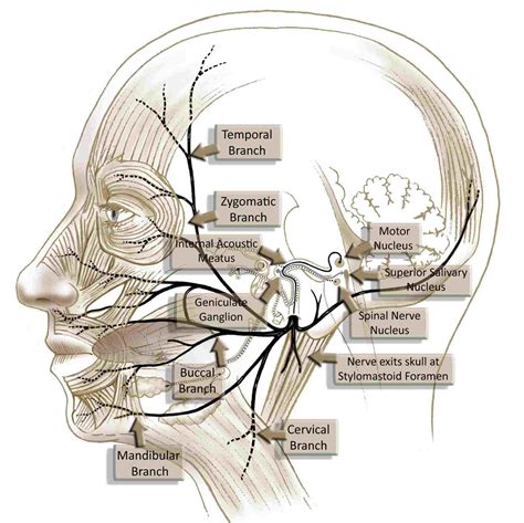 Facial Nerve Palsy Diagram