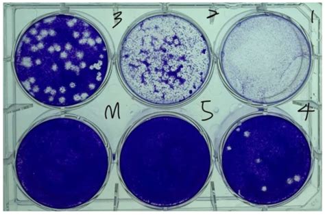 Micromachines Free Full Text Reduction Of Viral And Bacterial Activity By Using A Self