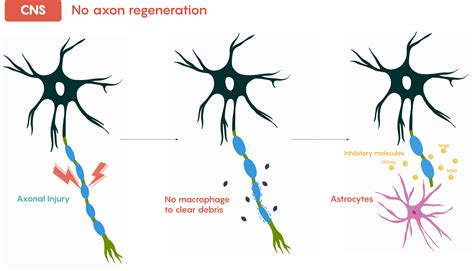 21 Acute Physical Damage To The Nervous System Neuroscience