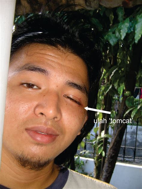 Rifqi Nur Hidayat Obat Serangan Serangga Tomcat
