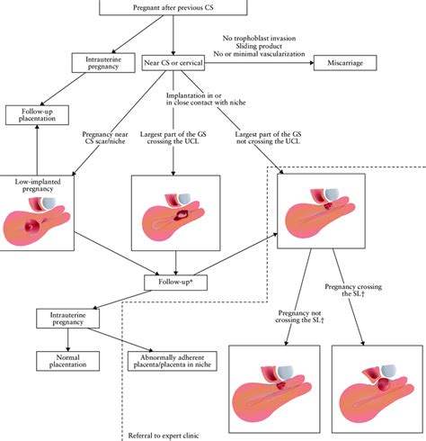 Flowchart Showing Evaluation Of The Cesarean Section Cs Scar In First