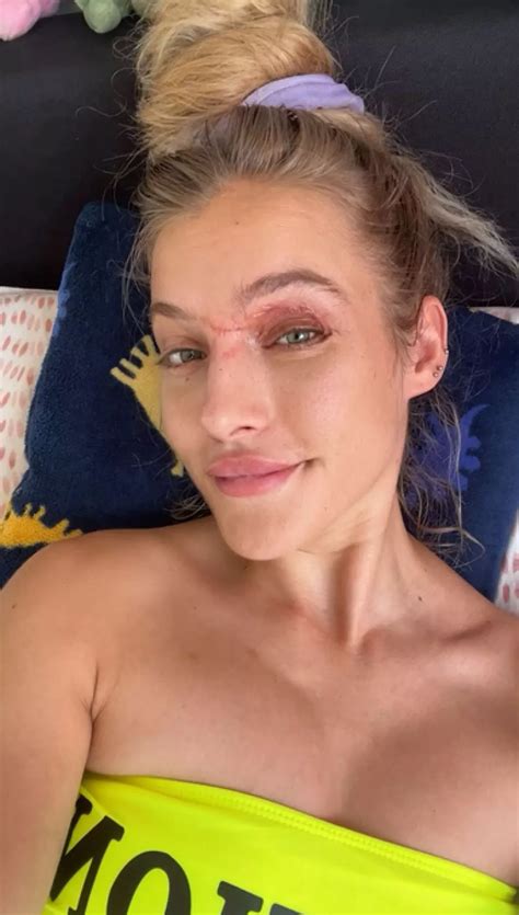 OnlyFans model can't remember anything from before summer 2024