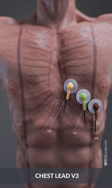 Ecg Lead Placement With 3d Illustrations 40 Off