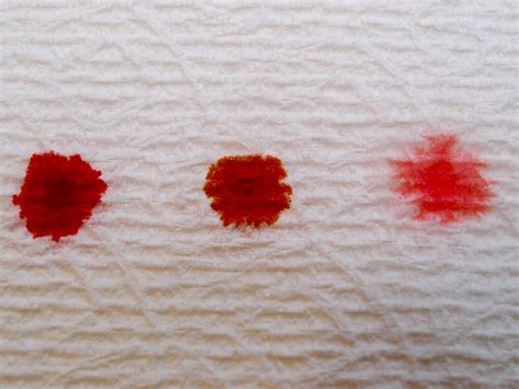 Bleeding or Spotting in Early Pregnancy: Should I Be Worried? - WeHaveKids