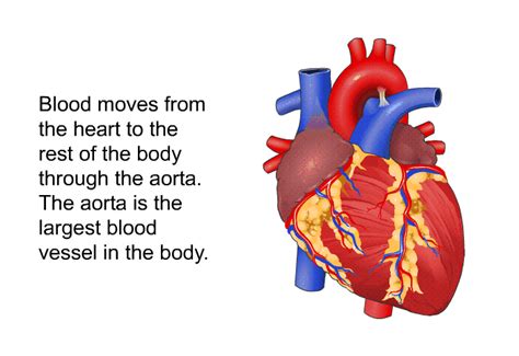 Intra Aortic Balloon Pump