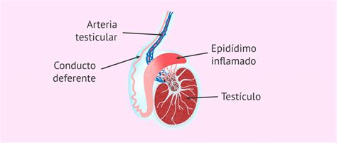 Urólogo Especialista En Epididimitis Cdmx Dr Carlos García Cruz