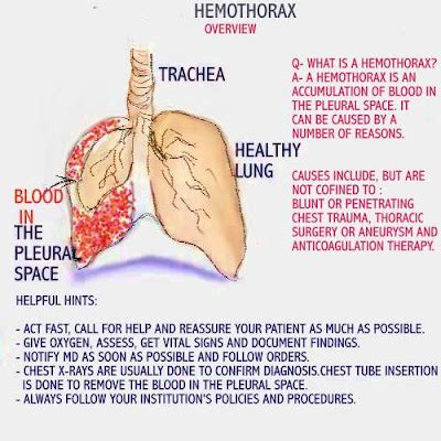 Dear Nurses: IDENTIFYING HEMOTHORAX IN THE CLINICAL SETTING