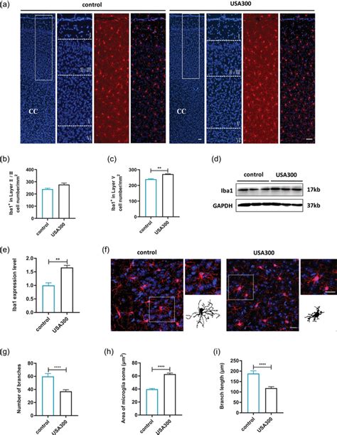 Effects Of USA300 Infection On The Microglia In The MPFC Of Mice A