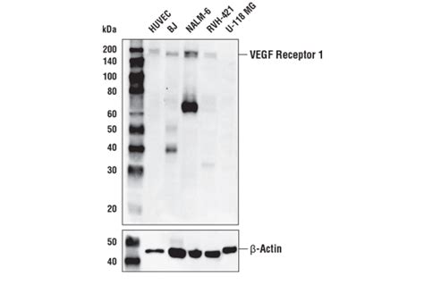 Vegf Receptor E T H Rabbit Mab Cell Signaling Technology