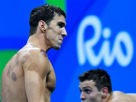 Michael Phelps Uses Cupping Therapy...Does It Work? | 'LLERO