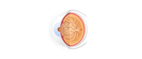 Detecting hidden signs of anemia from the eye