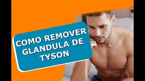 O Que E Glandula De Tyson