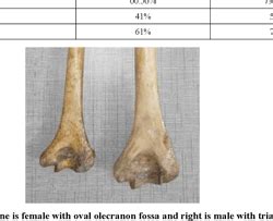 Figure From Sex Determination From Lower End Of Humerus Using Morphological Traits In Indian